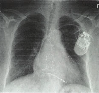 Froedtert South Cardiac X-Ray